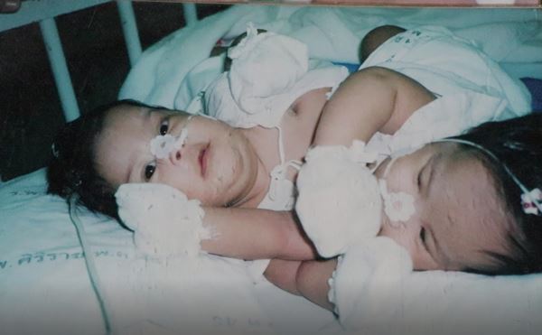 น้องไฟว์-น้องโฟร์ท แฝดสยาม น้องไฟว์-น้องโฟร์ท แฝดสยาม