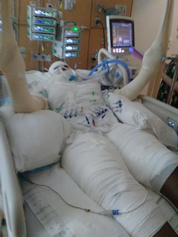 เผาตัวเอง เผาตัวเอง