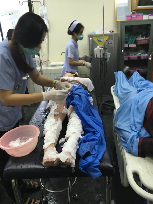 เรือสปีดโบ๊ท ระเบิดกลางเกาะพีพี เรือสปีดโบ๊ท ระเบิดกลางเกาะพีพี