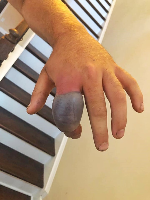 งูกัด งูกัด