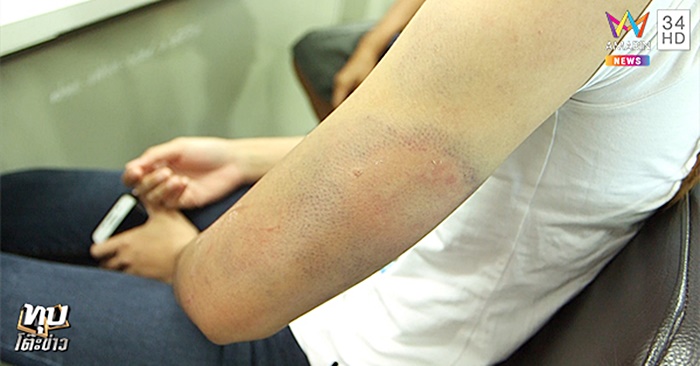 ทำร้ายผู้หญิง ทำร้ายผู้หญิง