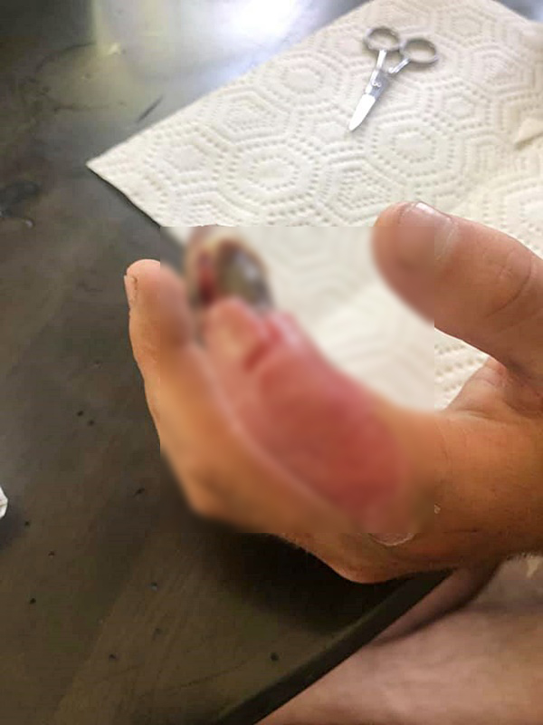 งูกัด งูกัด