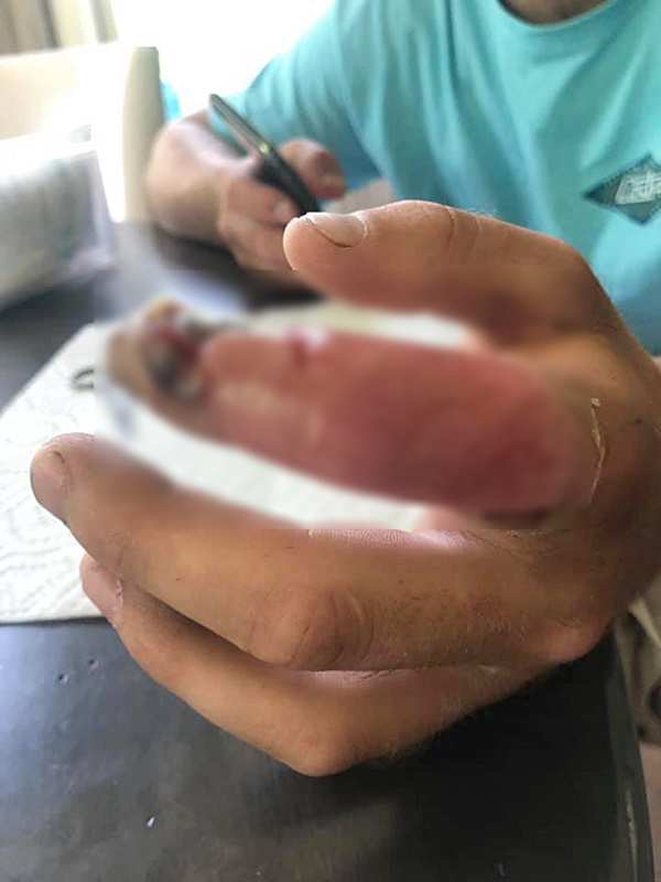 งูกัด งูกัด