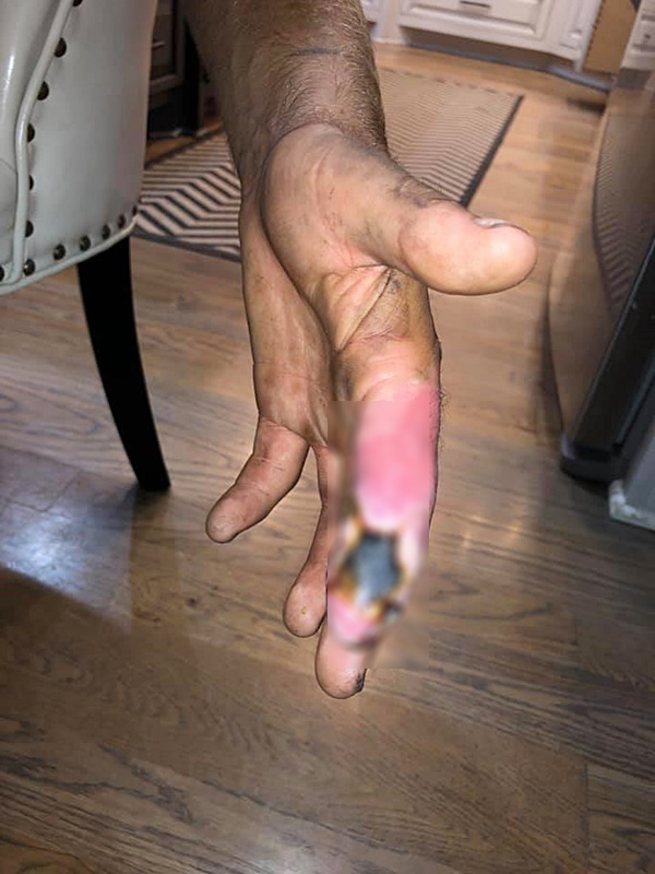 งูกัด งูกัด