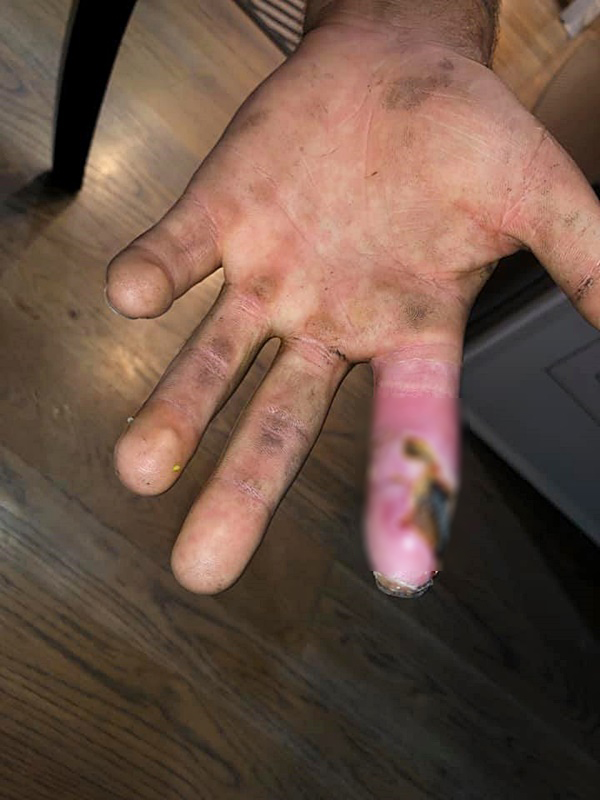 งูกัด งูกัด