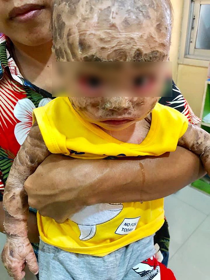 เด็กดักแด้ เด็กดักแด้