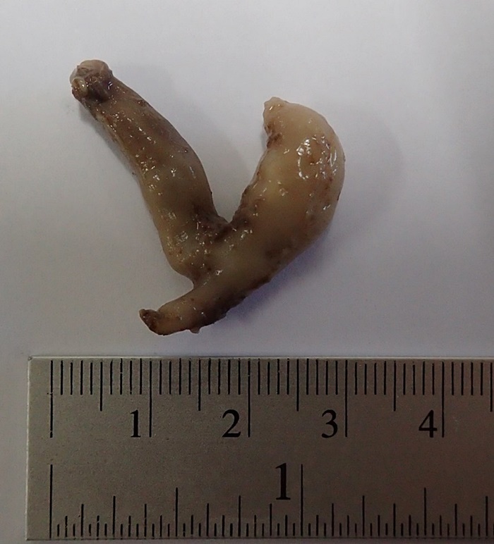 ไมโครพลาสติกในปลาทู ไมโครพลาสติกในปลาทู