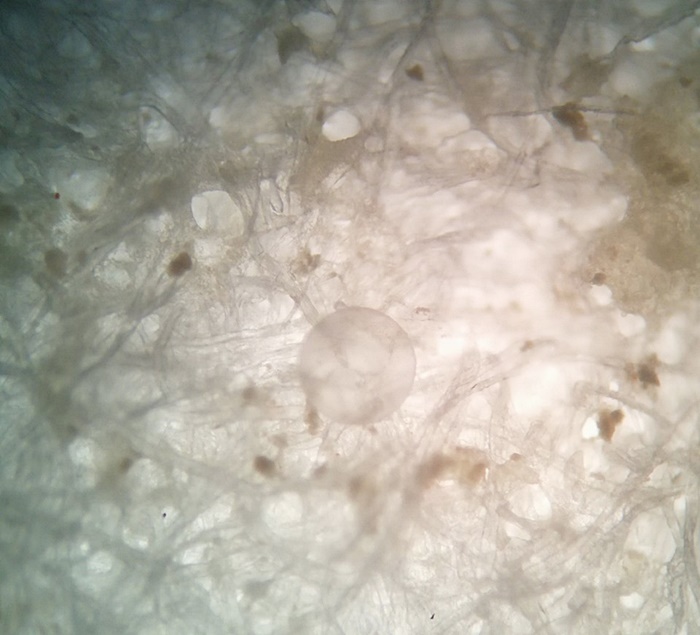 ไมโครพลาสติกในปลาทู ไมโครพลาสติกในปลาทู