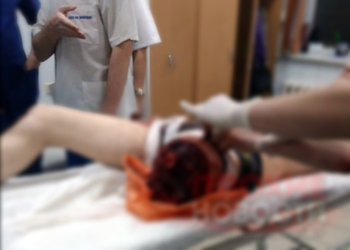 เลื่อยขาตัวเองขาด เลื่อยขาตัวเองขาด