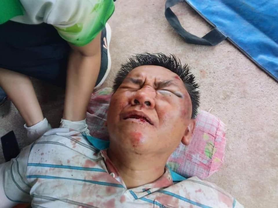 ผู้กองปูเค็ม ถูกรุมยำเละ ผู้กองปูเค็ม ถูกรุมยำเละ