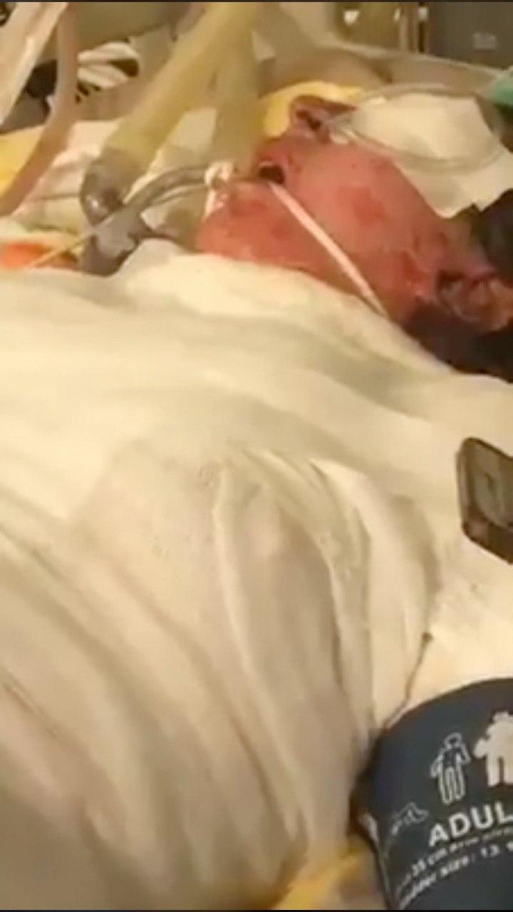 ทำร้ายเมีย ทำร้ายเมีย