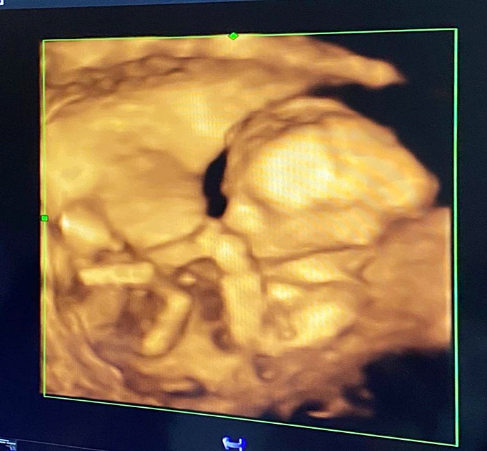 อุ๊งอิ๊ง แพรทองธาร อุ๊งอิ๊ง แพรทองธาร