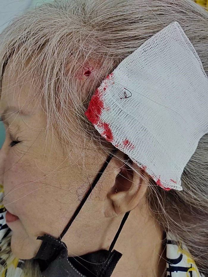 ศัลยกรรมทำพิษ ศัลยกรรมทำพิษ