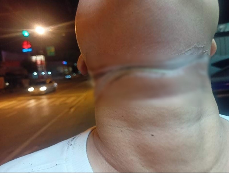 สายร่วงขวางถนน สายร่วงขวางถนน