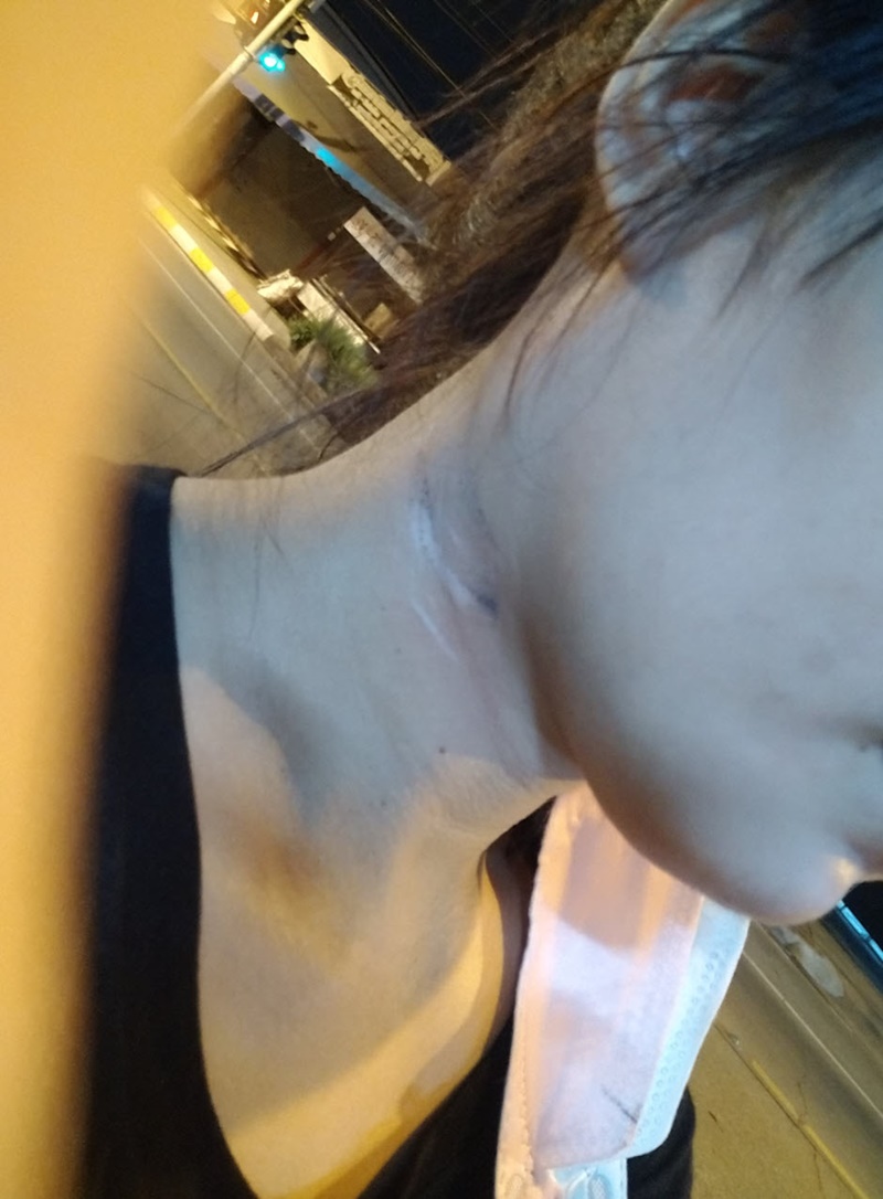 สายร่วงขวางถนน สายร่วงขวางถนน