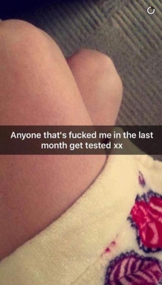 สาวอวดโซเชียล เป็นโรคหนองใน สาวอวดโซเชียล เป็นโรคหนองใน