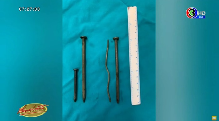 กลืนตะปูลงท้อง กลืนตะปูลงท้อง