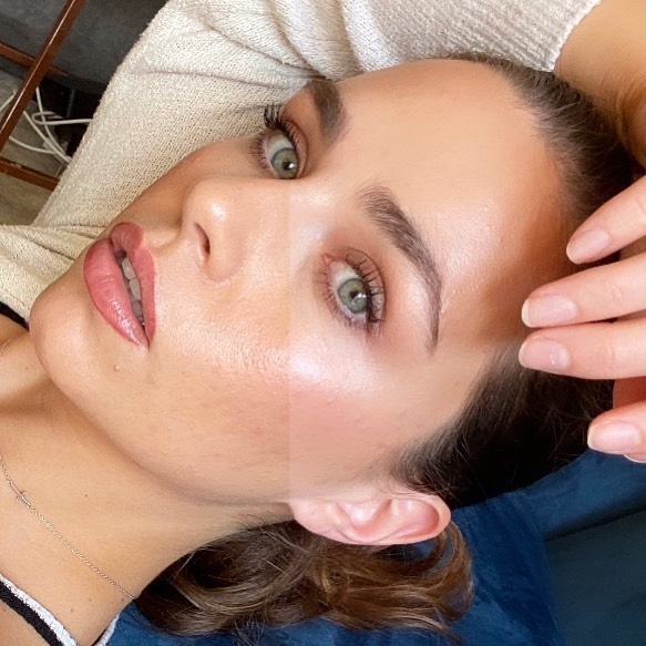 ฟิลเตอร์แต่งภาพ ฟิลเตอร์แต่งภาพ