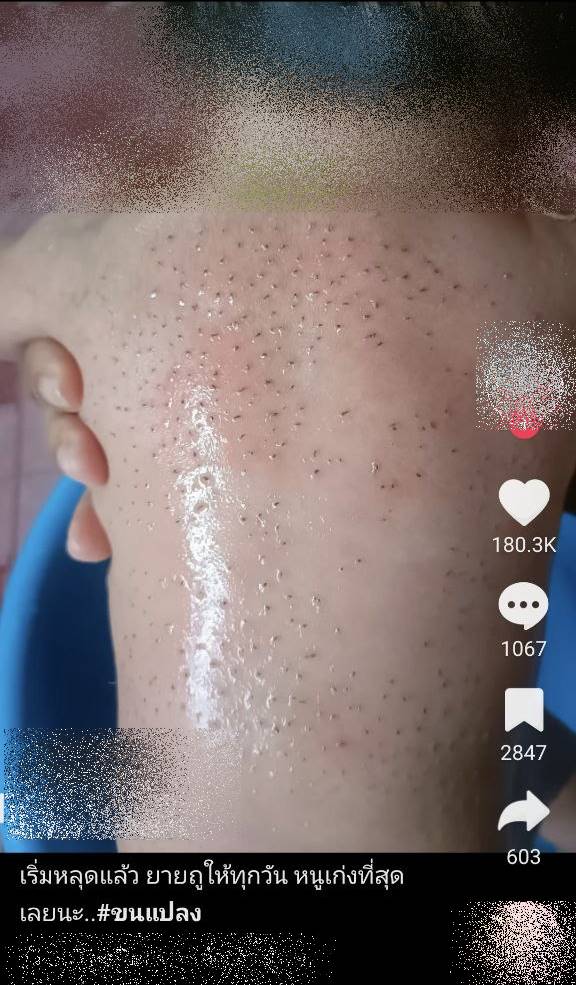 ใช้น้ำหมากถูขนแปรงทารก ใช้น้ำหมากถูขนแปรงทารก