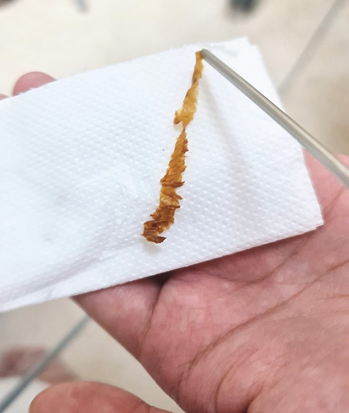 เห็นแล้วสยองเลย เห็นแล้วสยองเลย