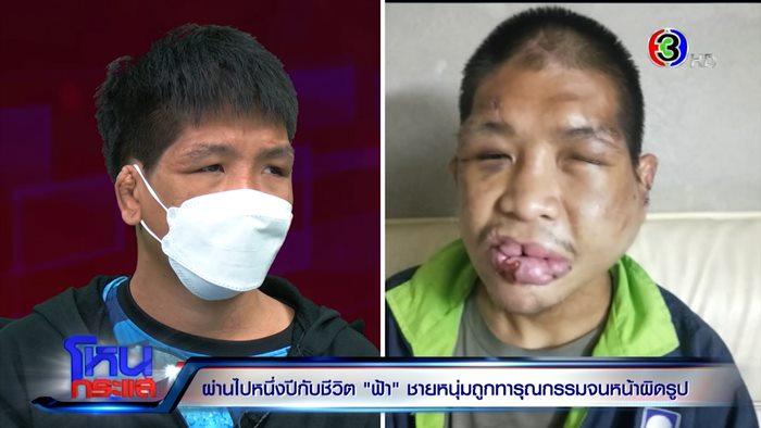 ชีวิตใหม่.. น้องฟ้า ถูกนายจ้างทารุณ ชีวิตใหม่.. น้องฟ้า ถูกนายจ้างทารุณ