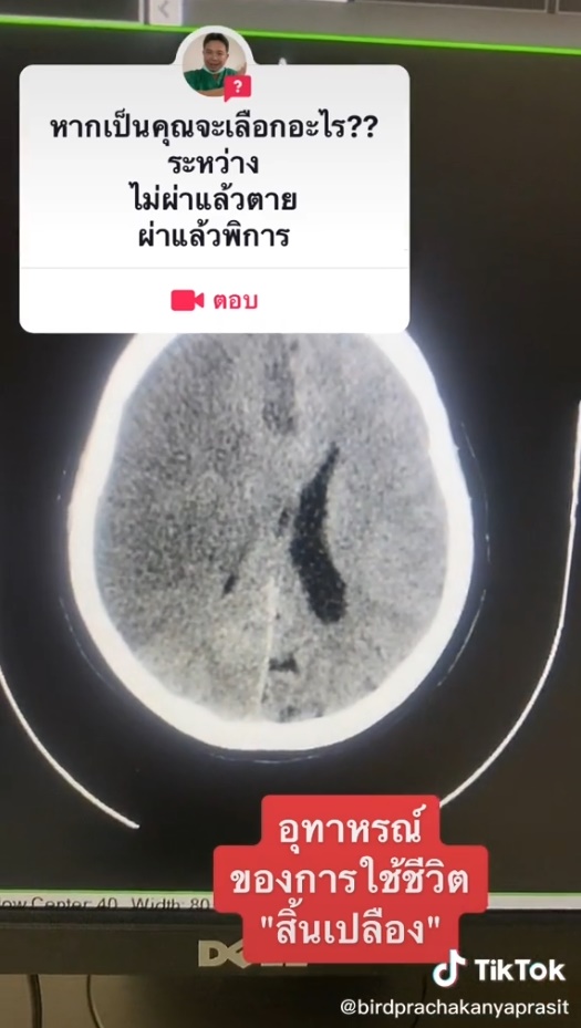 ควรเลือกทางไหน ควรเลือกทางไหน