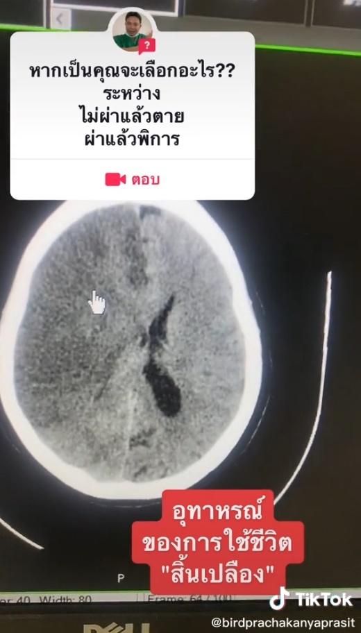ควรเลือกทางไหน ควรเลือกทางไหน