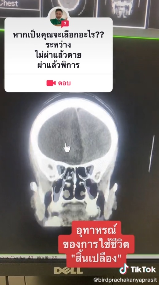 ควรเลือกทางไหน ควรเลือกทางไหน