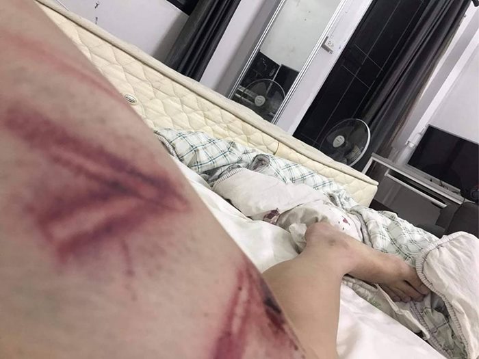 นักการเมืองทำร้ายลูก นักการเมืองทำร้ายลูก