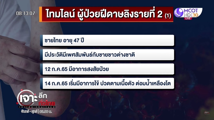 ฝีดาษลิงในไทย ฝีดาษลิงในไทย