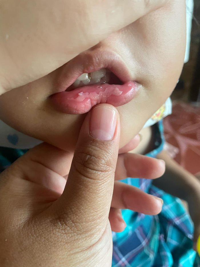 ขนมไนโตรเจนเหลว ขนมไนโตรเจนเหลว