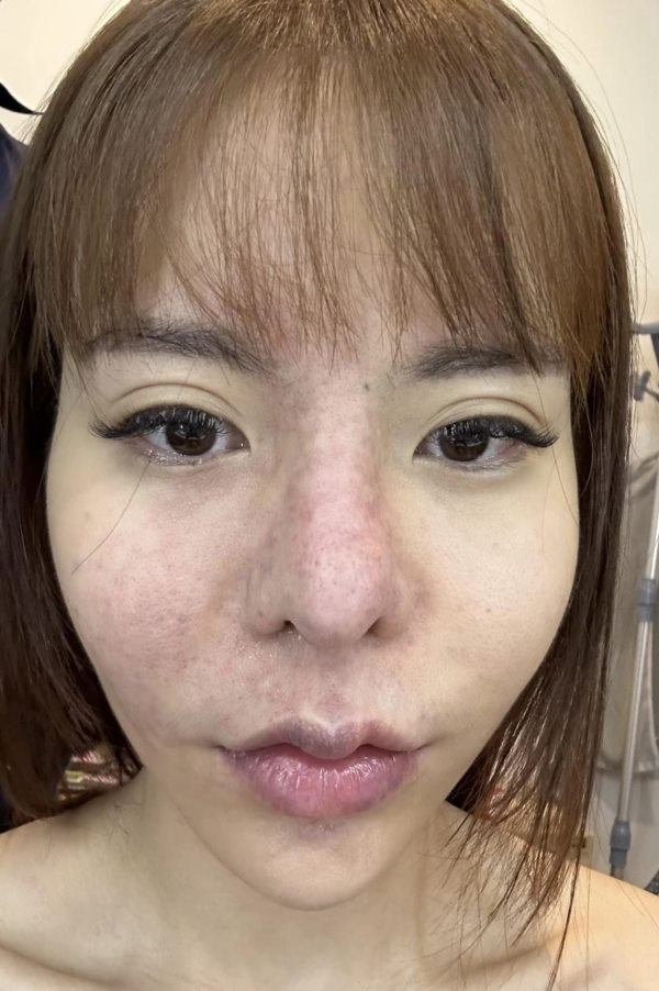 น้องมะลิ น้องมะลิ