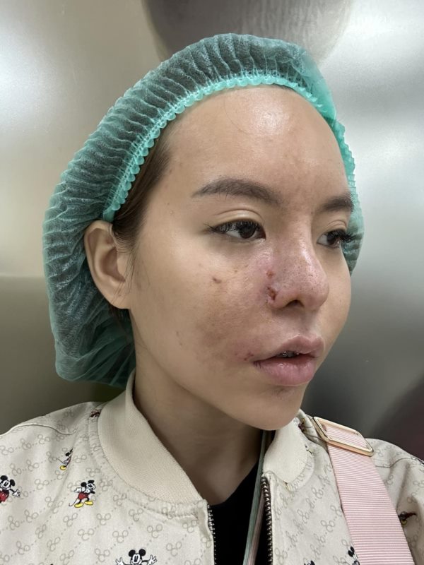 น้องมะลิ น้องมะลิ