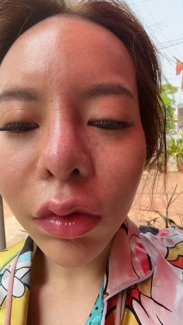 น้องมะลิ น้องมะลิ