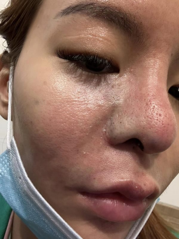 น้องมะลิ น้องมะลิ