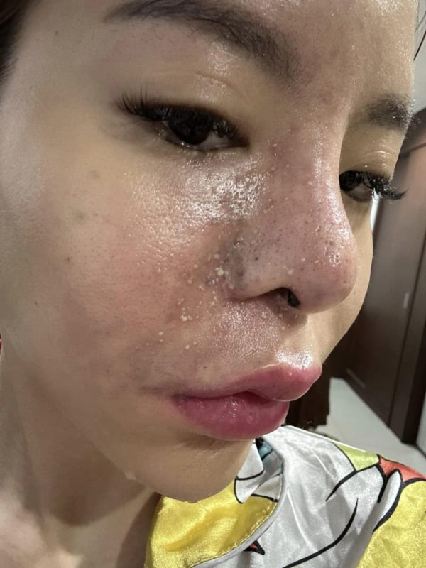 น้องมะลิ น้องมะลิ