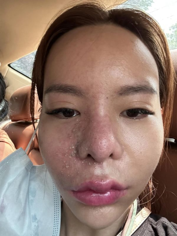 น้องมะลิ น้องมะลิ