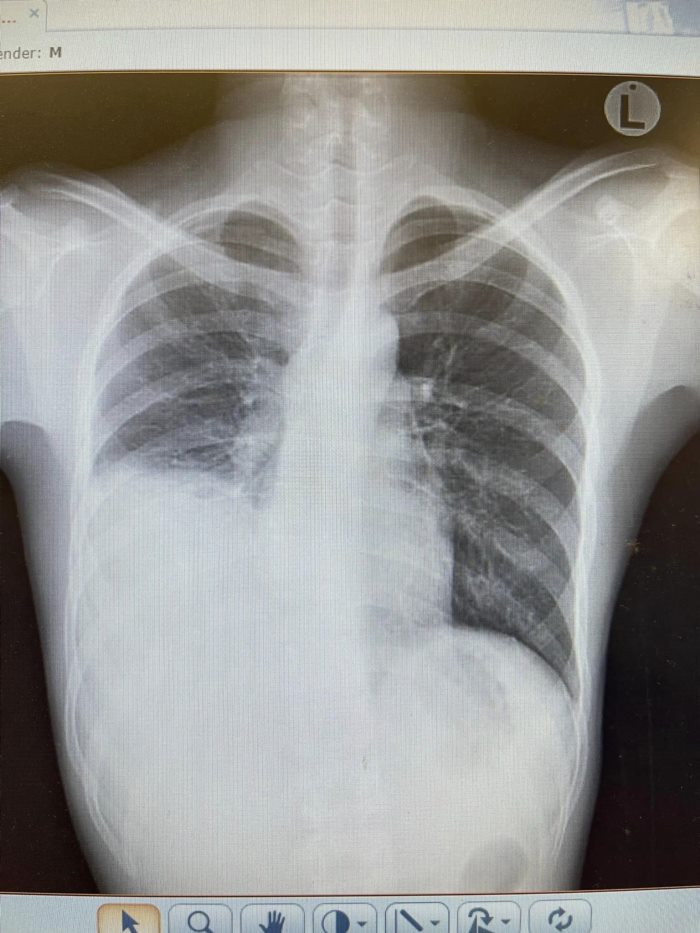 แนะตั้งสติก่อนกิน แนะตั้งสติก่อนกิน