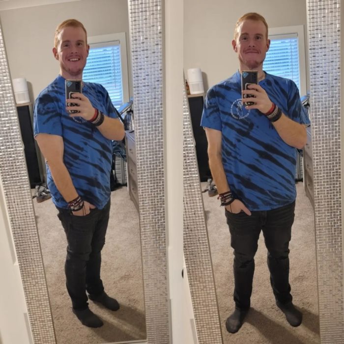 พลิกชีวิต จากอดีตอ้วน 383 กก. พลิกชีวิต จากอดีตอ้วน 383 กก.