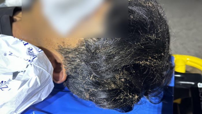 พาวเวอร์แบงค์ระเบิด พาวเวอร์แบงค์ระเบิด