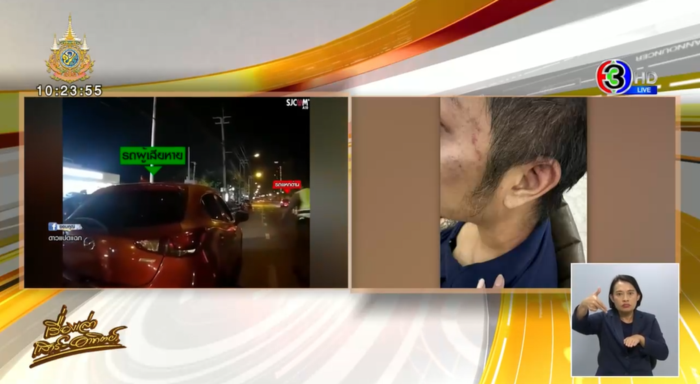 7 ตำรวจรุมทำร้ายลูกอดีตตำรวจ 7 ตำรวจรุมทำร้ายลูกอดีตตำรวจ