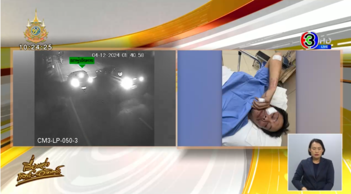 7 ตำรวจรุมทำร้ายลูกอดีตตำรวจ 7 ตำรวจรุมทำร้ายลูกอดีตตำรวจ