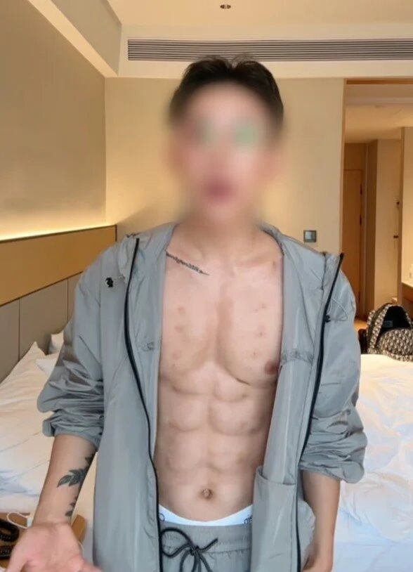 หนุ่มอยากมีกล้ามท้อง ยอมจ่าย 18 ล้าน สร้างกล้ามทางลัด แค่ซิกแพคมันน้อยไป หนุ่มอยากมีกล้ามท้อง ยอมจ่าย 18 ล้าน สร้างกล้ามทางลัด แค่ซิกแพคมันน้อยไป