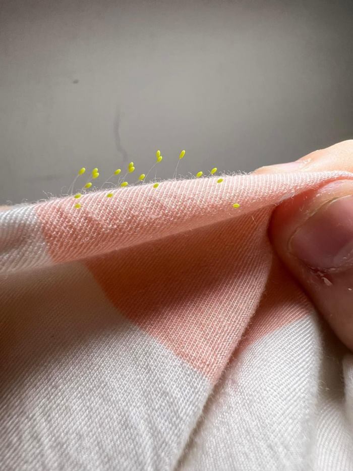 เจอวัตถุประหลาดบนหมอนลูกสาว เจอวัตถุประหลาดบนหมอนลูกสาว