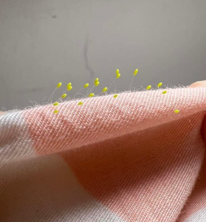 เจอวัตถุประหลาดบนหมอนลูกสาว เจอวัตถุประหลาดบนหมอนลูกสาว