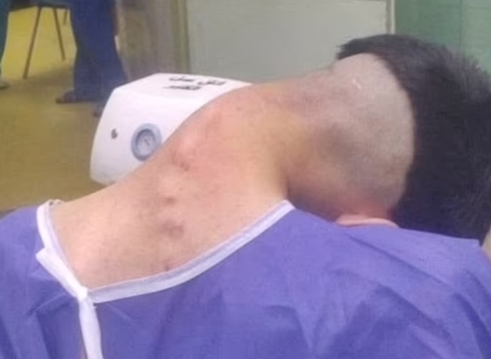 โรคศีรษะห้อย ! โรคศีรษะห้อย !