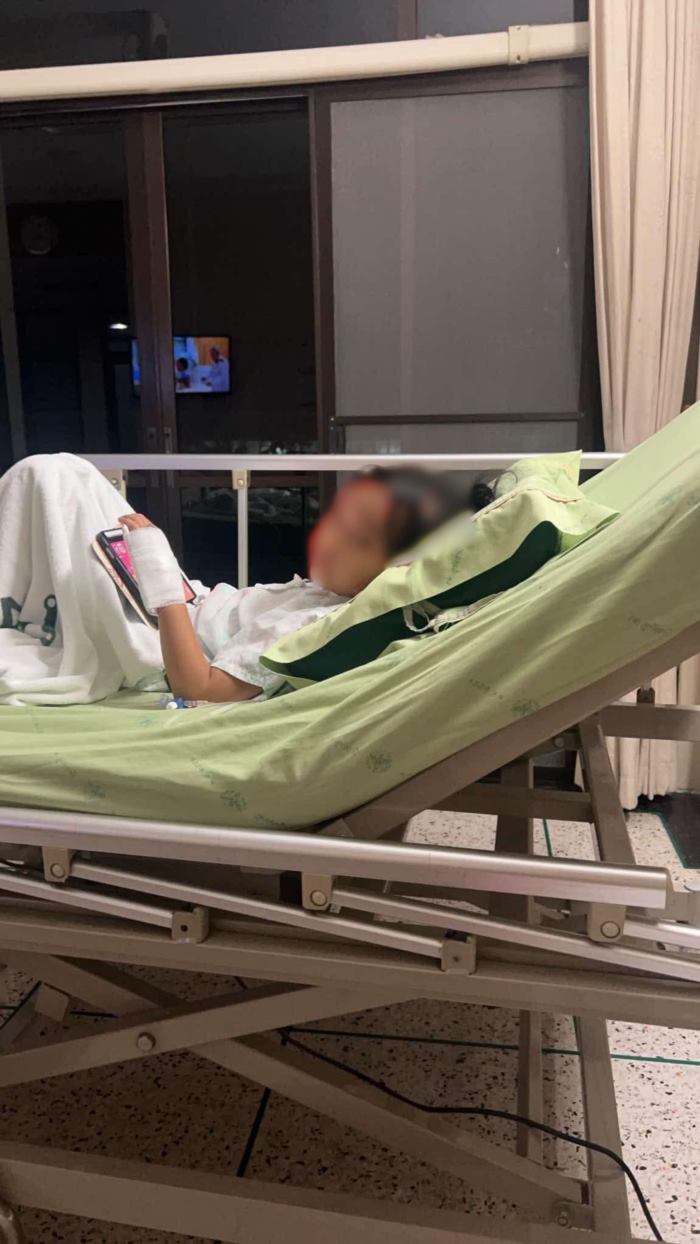 เด็กอนุบาล 3 ถูกแกล้งจนนิ้วขาด เด็กอนุบาล 3 ถูกแกล้งจนนิ้วขาด