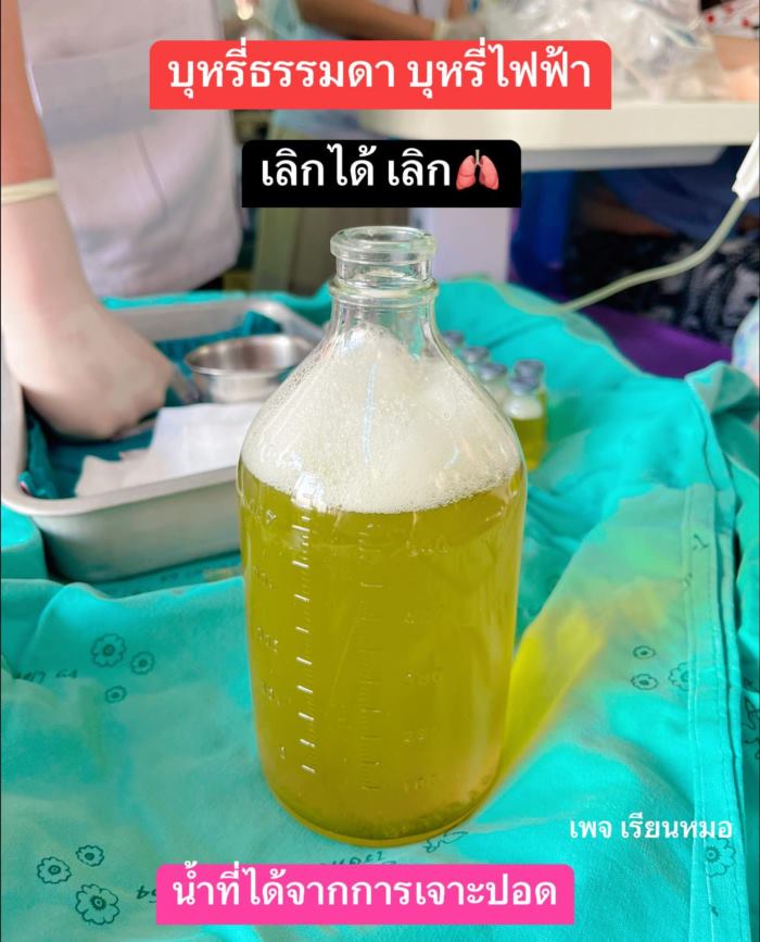 น้ำในปอด น้ำในปอด