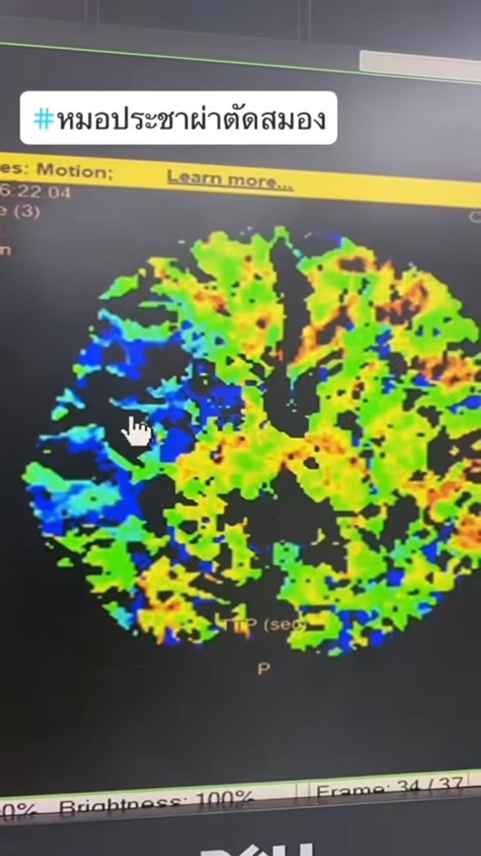 หญิง 50 ดื่มกาแฟแล้วใจสั่น หญิง 50 ดื่มกาแฟแล้วใจสั่น