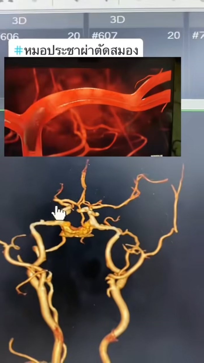 หญิง 50 ดื่มกาแฟแล้วใจสั่น หญิง 50 ดื่มกาแฟแล้วใจสั่น